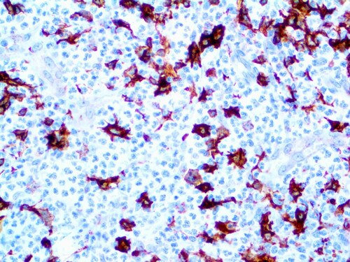 IHC of HLA-DRB1 beta chain on an FFPE Tonsil Tissue